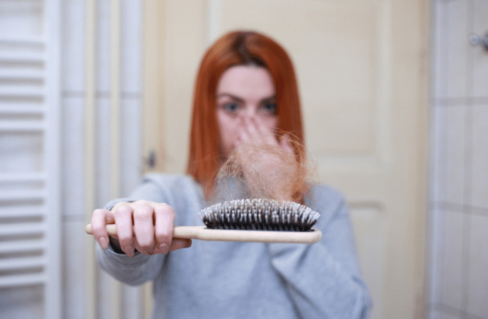 אישה מחזיקה מברשת עם נשירת שיער