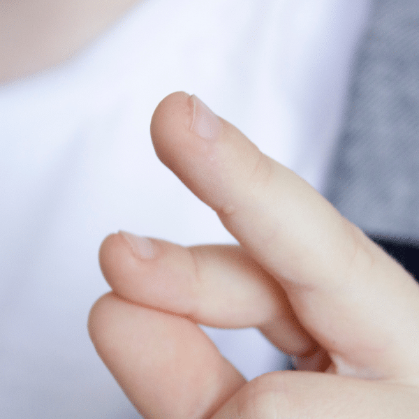 פטרת בציפורניים